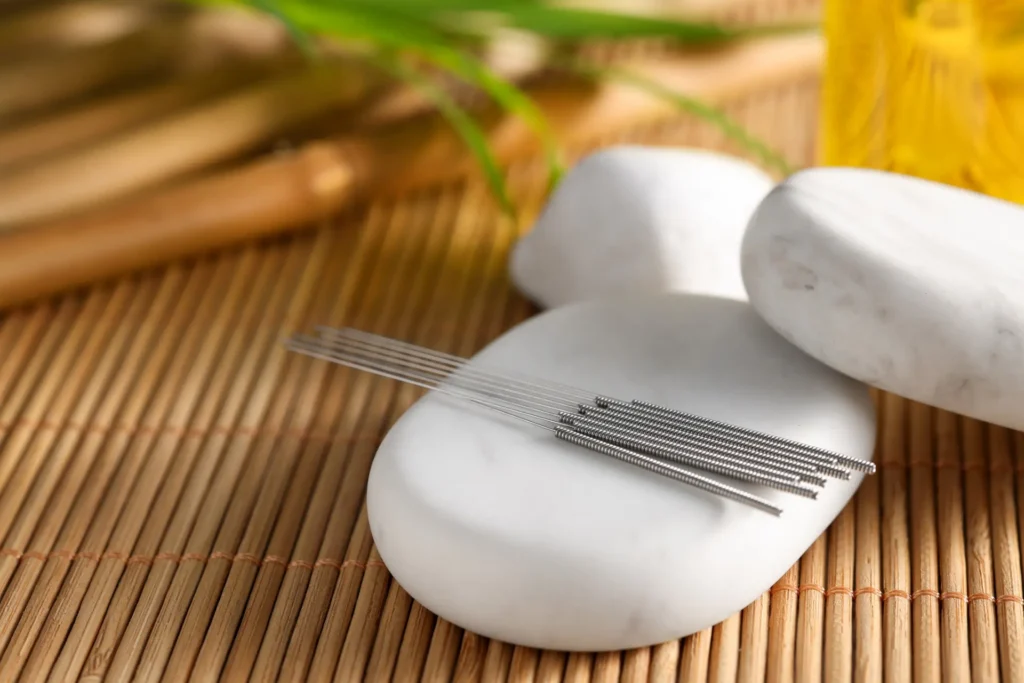 Acupuncture and IVF success explained