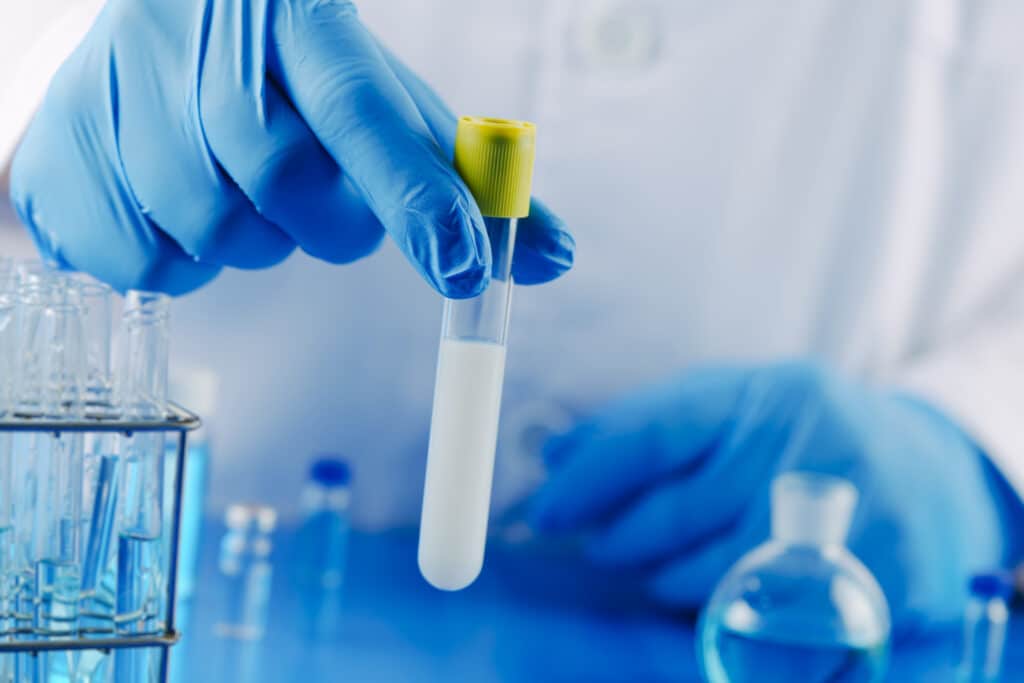 cómo la calidad del esperma afecta el éxito de la FIV